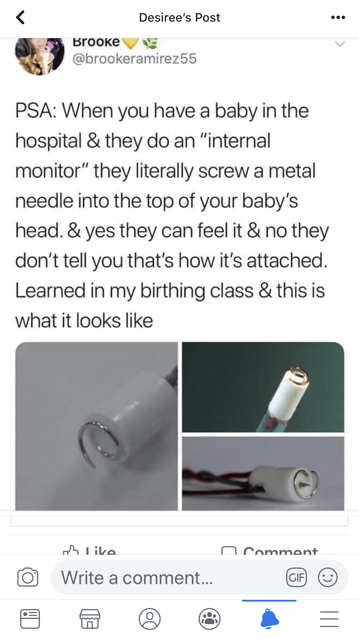 baby fetal monitor